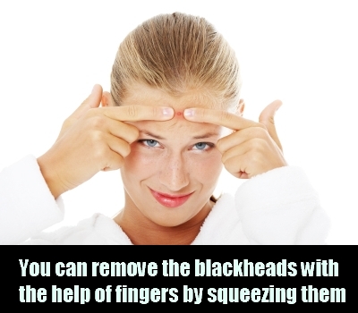 Get Rid Of Stubborn Blackheads With These Natural Remedies Get Rid Of Stubborn Blackheads With These Natural Remedies