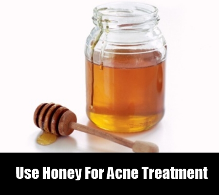 Natural Ways To Prevent Acne Breakouts Natural Ways To Prevent Acne Breakouts