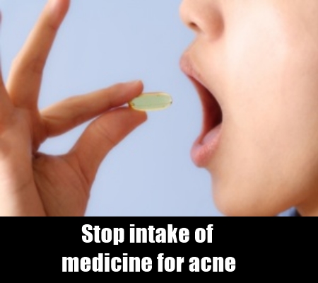 Natural Way To Cure Acne Fast Natural Way To Cure Acne Fast