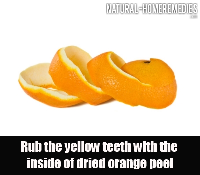 Top Home Remedies For Whiter Teeth - How To Whiten Teeth With Home 