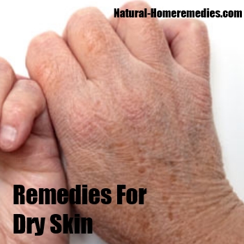 What are some home remedies for dry and cracked hands?