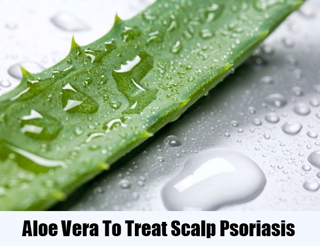 5 Remedies For Scalp Psoriasis – Natural Home Remedies 5 Remedies For Scalp Psoriasis – Natural Home Remedies