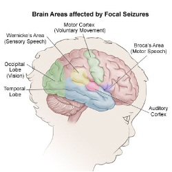 Natural Remedies For Simple Partial Seizures Natural Remedies For Simple Partial Seizures