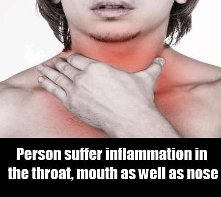 Inflammation In The Throat 58