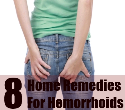 What is a hemorrhoid hemorrhoids definition