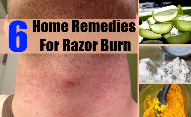 Natural Treatments For Razor Burn Natural Treatments For Razor Burn