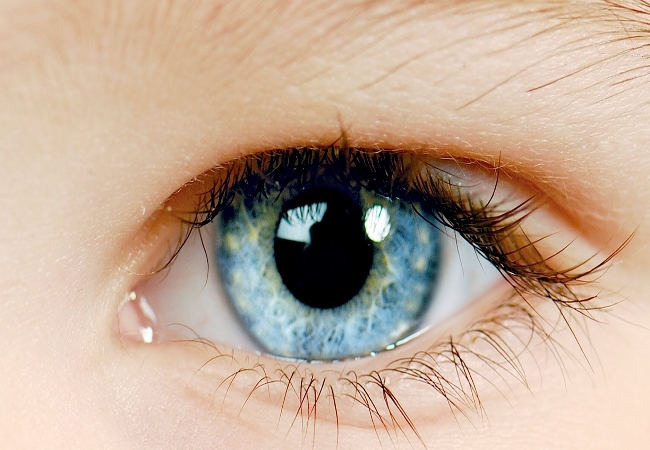 Watery Itchy Eyes Natural Remedies Watery Itchy Eyes Natural Remedies