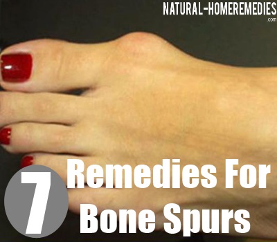 Home Remedies For Bone Spurs On Top Of Foot Home Remedies For Bone Spurs On Top Of Foot