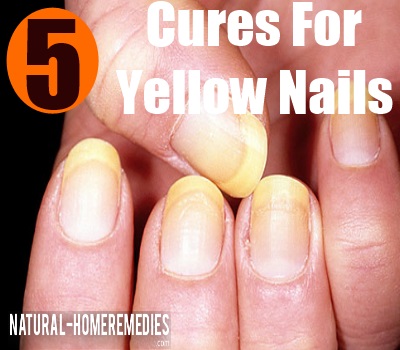 How To Cure Yellow Nails Naturally How To Cure Yellow Nails Naturally