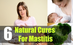 Mastitis Treatment Natural Remedies Mastitis Treatment Natural Remedies