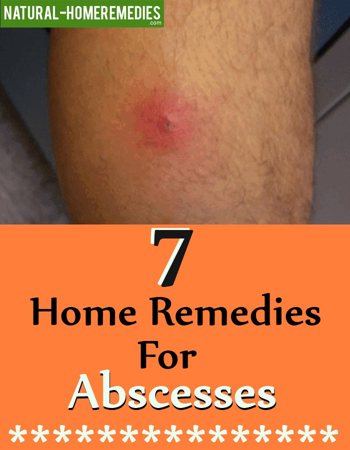 7 Home Remedies For Abscesses Natural Home Remedies & Supplements