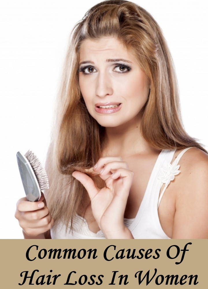 Natural Supplements For Hair Loss In Women 82