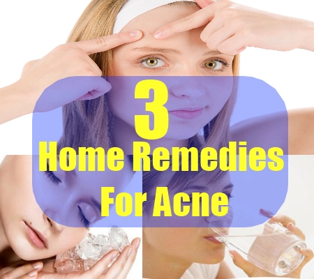 Home Remedies For Acne – Natural Home Remedies Fitness Guide